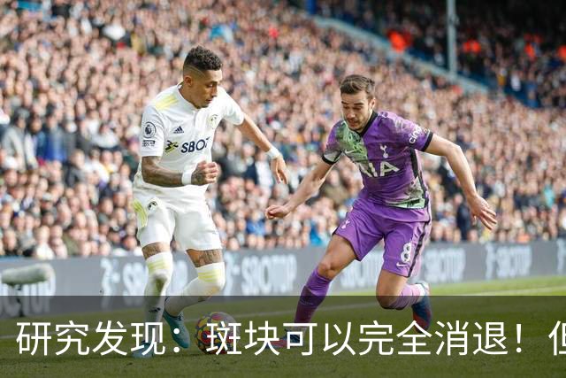 研究发现：斑块可以完全消退！但需要满足4个条件